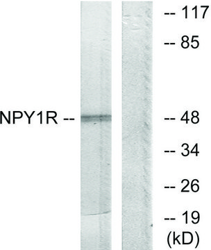 Anti-NPY1R antibody produced in rabbit