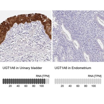 Anti-UGT1A6 antibody produced in rabbit