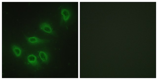 Anti-ENOS antibody produced in rabbit