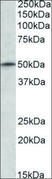 Anti-TRIM35 (N-terminal) antibody produced in