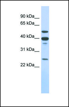 Anti-MMP13 antibody produced in rabbit