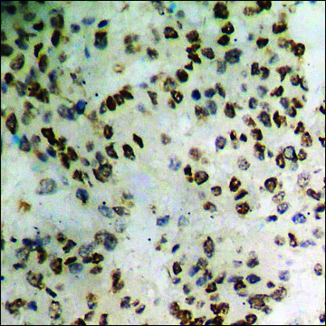 Anti-phospho-Catenin-?1 (pTyr²²?) antibody produced in