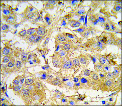 Anti-MIPEP (N-term) antibody produced in