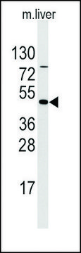 Anti-ULK3 (center) antibody produced in
