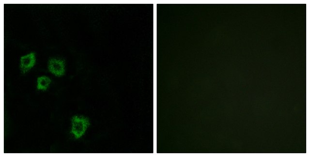 Anti-MUC16 antibody produced in rabbit