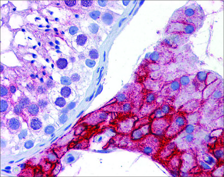 Anti-ACE2 antibody produced in rabbit