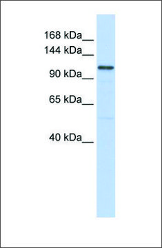 Anti-ADCY8 antibody produced in rabbit