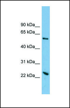 Anti-TMEM161A antibody produced in rabbit