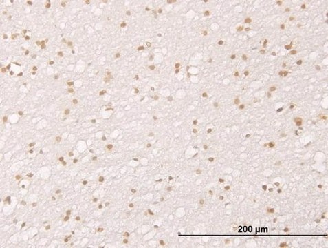 Monoclonal Anti-MDM2 antibody produced in