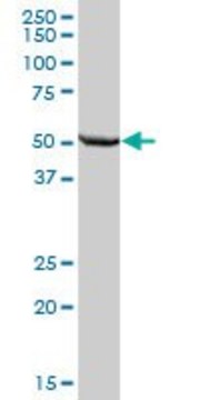 Anti-ALDH7A1 antibody produced in mouse