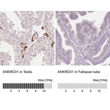 Anti-ANKRD31 antibody produced in rabbit