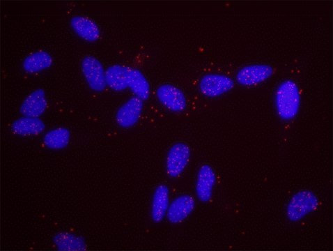 CRSP1 and Estrogen Receptor Alpha