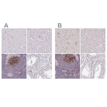 Anti-TMEM119 antibody produced in rabbit