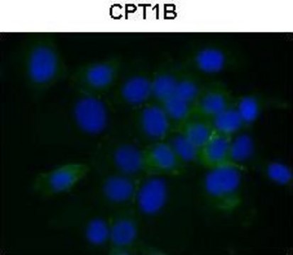 Anti-CPT1B antibody produced in rabbit