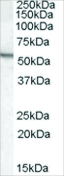 Anti-Arylsulfatase A antibody produced in