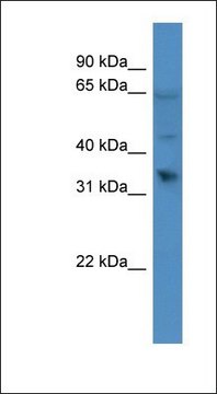 Anti-OR1D2 antibody produced in rabbit