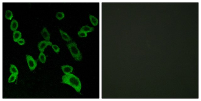Anti-GPR139 antibody produced in rabbit