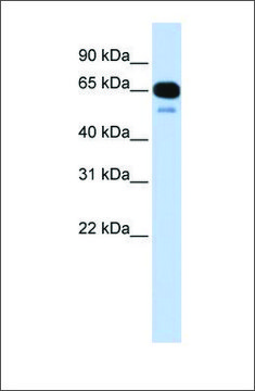 Anti-SLC22A8 antibody produced in rabbit