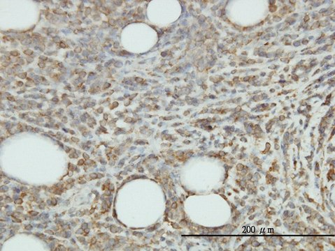 Monoclonal Anti-JAM2 antibody produced in