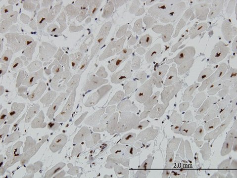 Monoclonal Anti-MECP2 antibody produced in