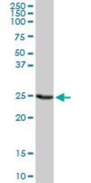 Anti-PSMD9 antibody produced in rabbit