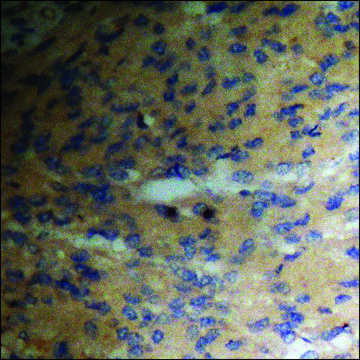 Anti-phospho-PKC ? (pThr???) antibody produced