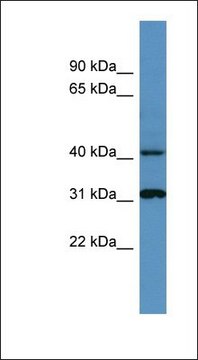 Anti-CTSD antibody produced in rabbit