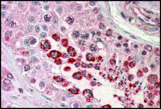 Anti-GAGED2 (C-terminal) antibody produced in