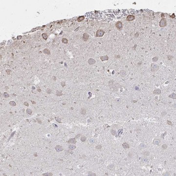 Anti-C20orf24 antibody produced in rabbit