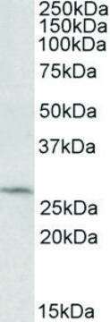 Anti-DCUN1D1 (C-terminal) antibody produced in