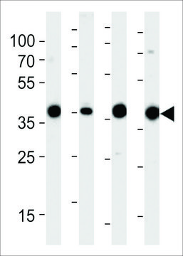 ANTI-ALDOLASE (ALDOA)(N-TERMINAL) antibody produced in