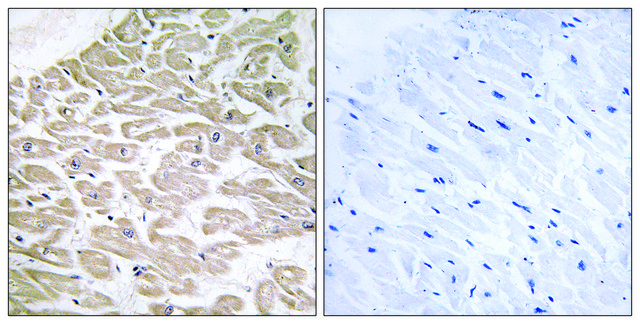 Anti-RAD antibody produced in rabbit