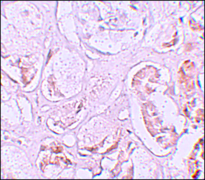 Anti-SLAMF9 antibody produced in rabbit
