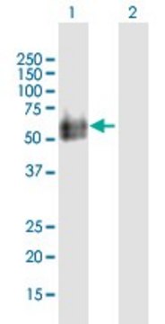 Anti-HYAL2 antibody produced in mouse