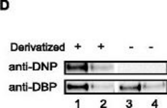 Anti-Vitamin D-Binding Protein/GC antibody produced