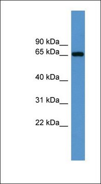 Anti-IGF2BP3 antibody produced in rabbit