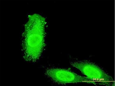 ANTI-IRAK3 antibody produced in mouse