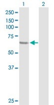Anti-SESN1 antibody produced in rabbit