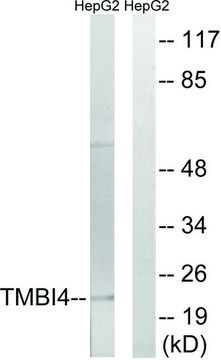 Anti-TMBIM4 antibody produced in rabbit