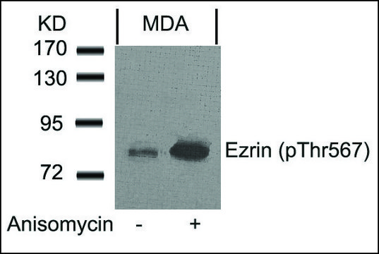 Anti-phospho-EZR (pThr???) antibody produced in