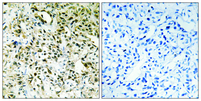 Anti-PPHLN antibody produced in rabbit