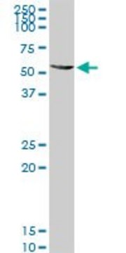 Anti-ALDH4A1 antibody produced in rabbit
