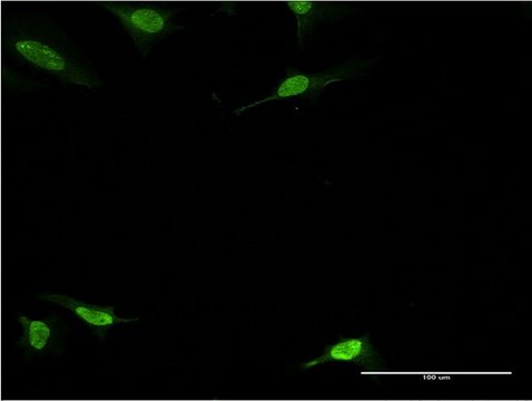 ANTI-PBK antibody produced in mouse