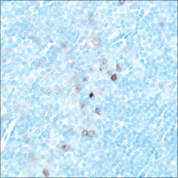 Anti-CD25 antibody, Rabbit monoclonal