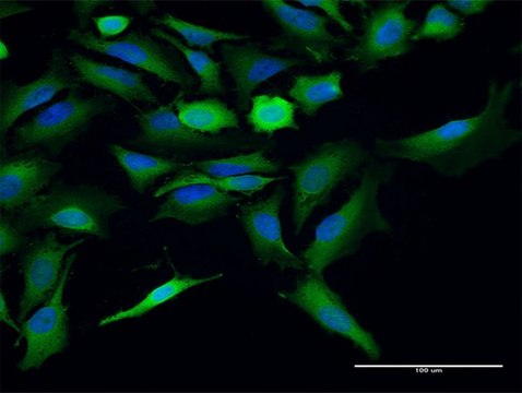 Anti-ST13 antibody produced in mouse