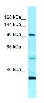 Anti-ROR1 (N-terminal) antibody produced in