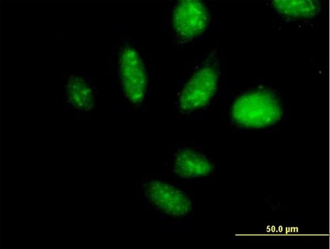 Anti-TAF1B antibody produced in mouse