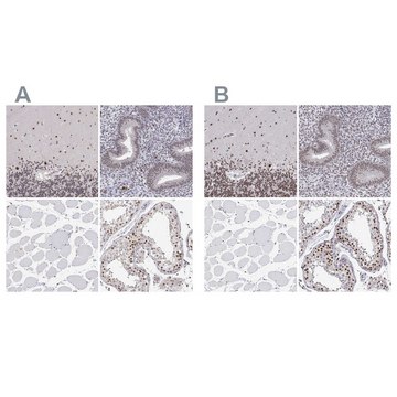 Anti-ADAR antibody produced in rabbit