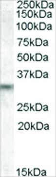 Anti-PRUNE2/BMCC1 antibody produced in goat