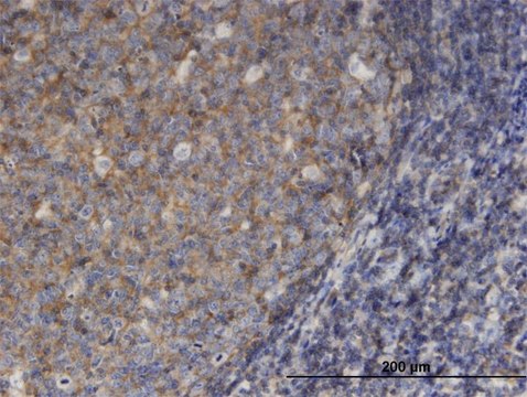 Monoclonal Anti-MSN antibody produced in